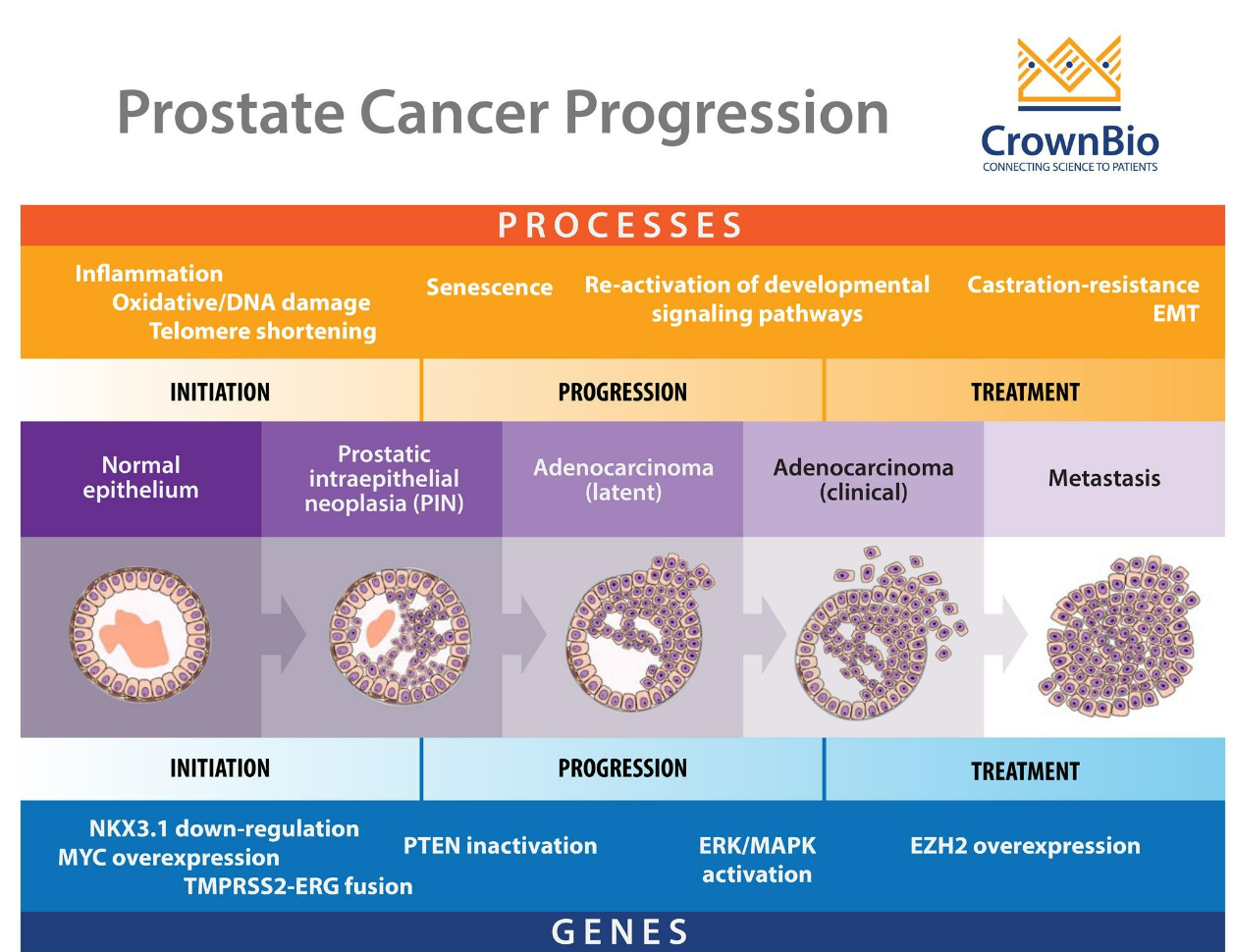 Prostate Cancer: What’s Your Risk?