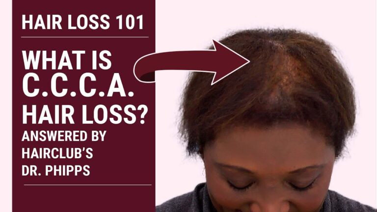 What is Concentric Centrifugal Cicatricial Alopecia (CCCA) with Dr ...