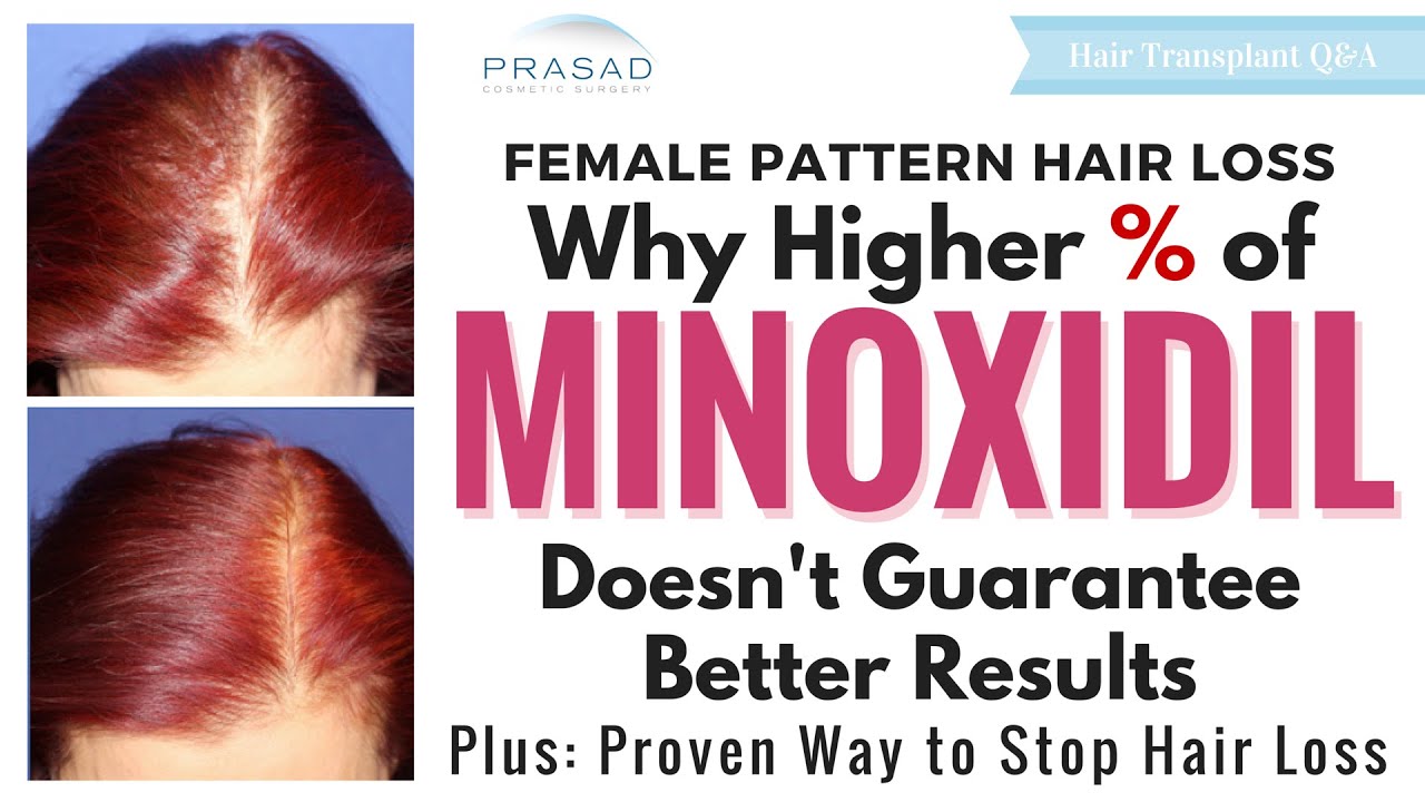 Hair Loss in Women – Why Stronger Minoxidil Doesn’t Mean Better Results, and a Proven Alternative