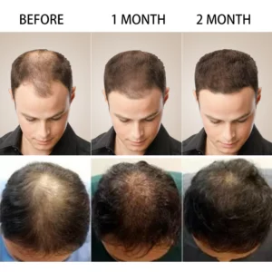 Men How to Grow Hair Fast